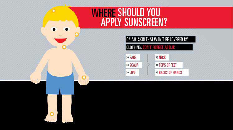 Puntos donde aplicar protector solar que se muestran en la ilustración de un niño.